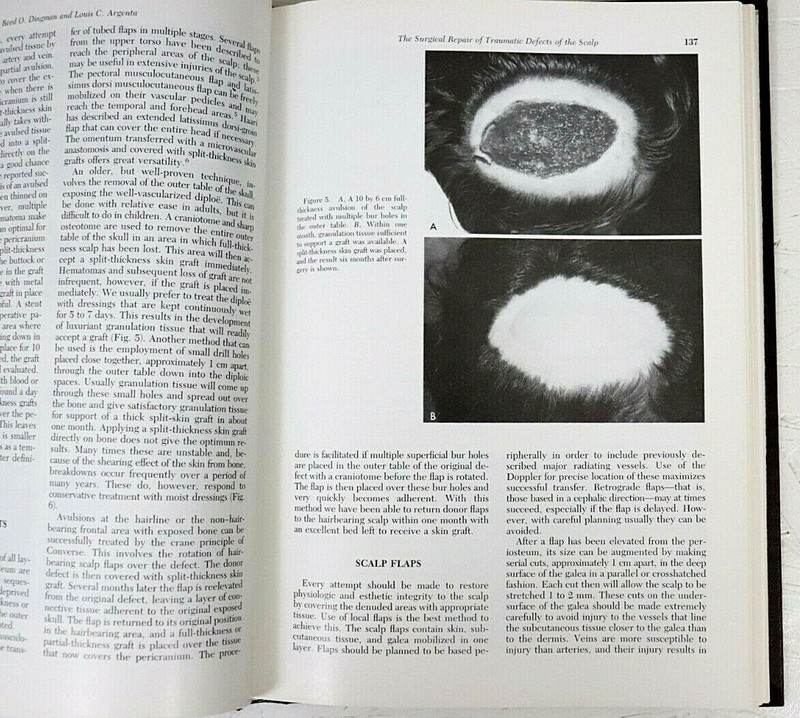 Clinics in Plastic Surgery Vol9 #2 April 1982 Scalp Defects and injuries Rogers gallery